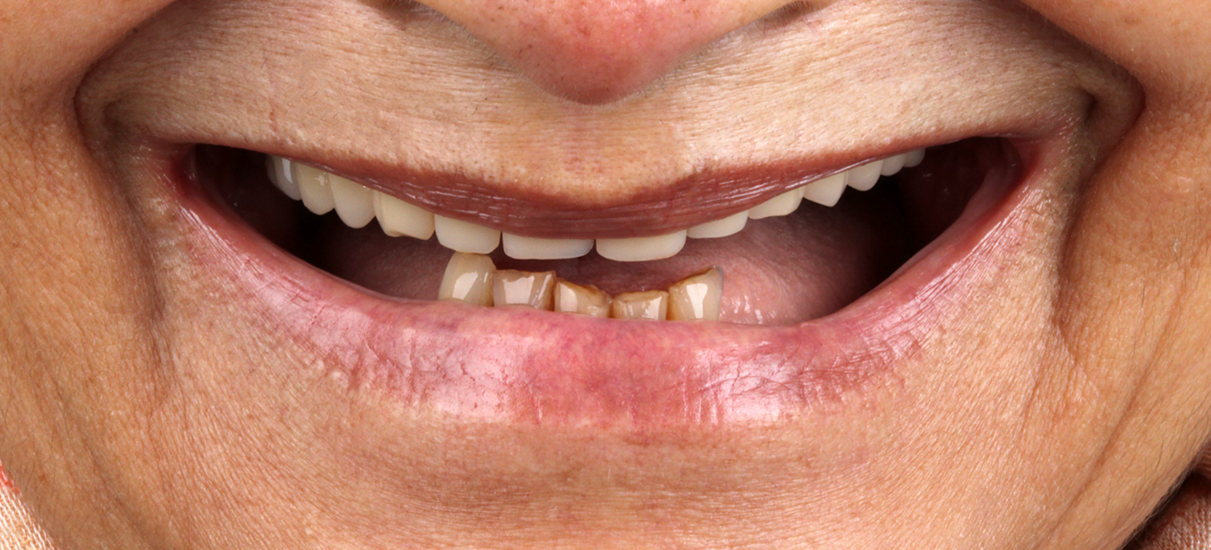 Sorriso antes de procedimento